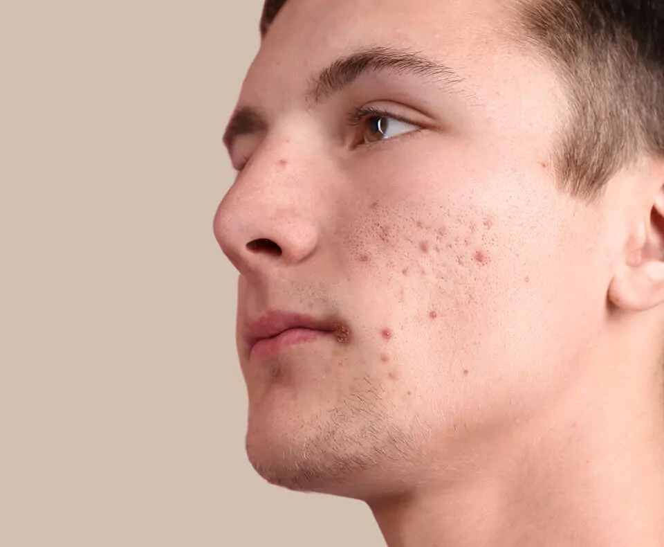 before-image-three before-image-three